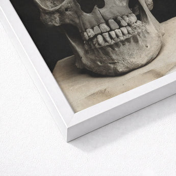 Study of a Human Skull Art Print / Canvas Framed Black-and-white Photograph Textured Stone-like Visible Teeth Bone Meets Lens, Prints