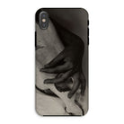 Hands and Horse Skull - Alfred Stieglitz Iphone Case - Xs / Matte