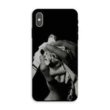 Stretch Corset - 1930s Fashion Photography Iphone Case, Xs Max / Matte, Black Phone Case Monochrome Hand