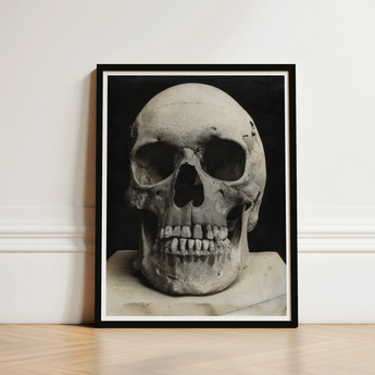 Study of a Human Skull Art Print / Canvas Black-framed Photographic Monochrome Textured Weathered Bone Meets Lens, Prints